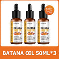 Naturals Oil Fast Hair Growth